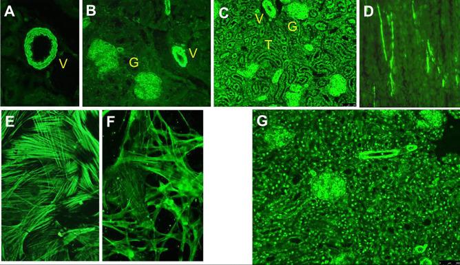 https://cdn.ncbi.nlm.nih.gov/pmc/blobs/8672/9464171/be69d9996898/12016_2021_8888_Fig3_HTML.jpg