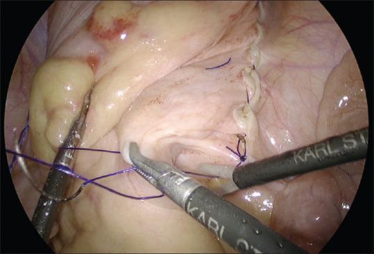 https://cdn.ncbi.nlm.nih.gov/pmc/blobs/8674/8973478/75dfb172903b/JMAS-18-295-g005.jpg