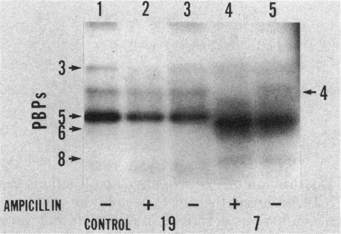https://cdn.ncbi.nlm.nih.gov/pmc/blobs/8675/210414/f9eed02eb640/jbacter00176-0457-a.jpg