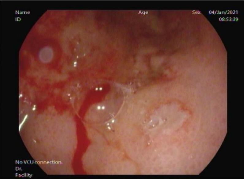 https://cdn.ncbi.nlm.nih.gov/pmc/blobs/8675/8900715/d7e047a94157/qmj-2022-015-g004.jpg