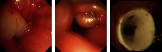 https://cdn.ncbi.nlm.nih.gov/pmc/blobs/8679/11498979/35ca7aac1f69/CRJ2024-2145560.001.jpg