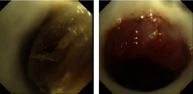 https://cdn.ncbi.nlm.nih.gov/pmc/blobs/8679/11498979/c117c868dd53/CRJ2024-2145560.002.jpg