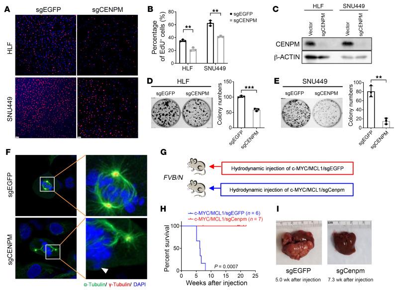 https://cdn.ncbi.nlm.nih.gov/pmc/blobs/867a/11563669/726401f37455/jci-134-174415-g204.jpg
