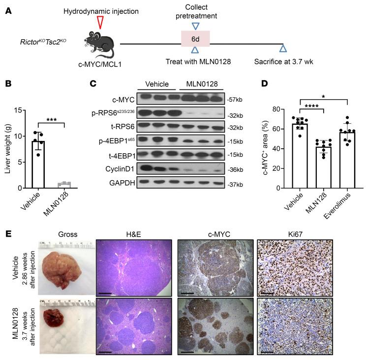https://cdn.ncbi.nlm.nih.gov/pmc/blobs/867a/11563669/7c09405b6740/jci-134-174415-g201.jpg