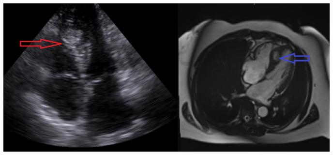 https://cdn.ncbi.nlm.nih.gov/pmc/blobs/867c/12313280/eb66f27d195f/jchim-15-03-076f1.jpg