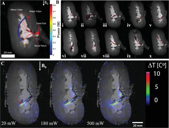 https://cdn.ncbi.nlm.nih.gov/pmc/blobs/867e/8981448/718d611a43cc/ADVS-9-2105352-g005.jpg