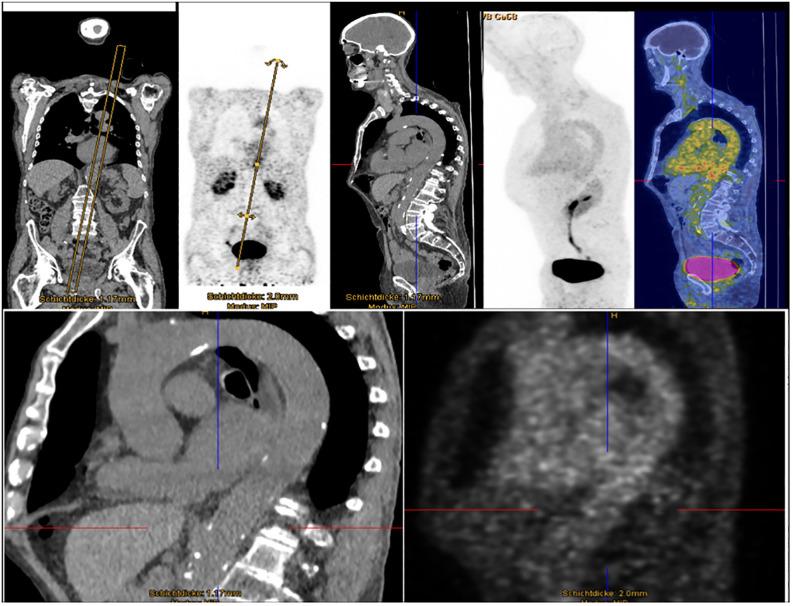 https://cdn.ncbi.nlm.nih.gov/pmc/blobs/8680/11701584/0fcfd9ad51a4/fimmu-15-1501790-g003.jpg