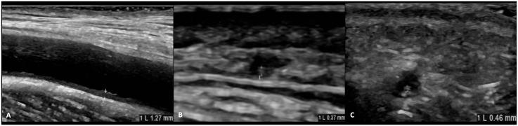 https://cdn.ncbi.nlm.nih.gov/pmc/blobs/8680/11701584/d65f0ca110a8/fimmu-15-1501790-g002.jpg