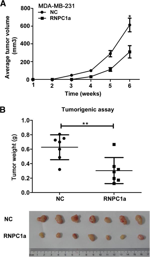 https://cdn.ncbi.nlm.nih.gov/pmc/blobs/8682/4101826/7c581dfe2bac/1471-2407-14-322-6.jpg