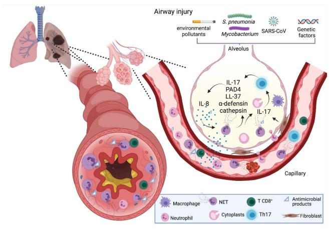 https://cdn.ncbi.nlm.nih.gov/pmc/blobs/8684/8230648/fceb57b8c32d/cells-10-01469-g003.jpg