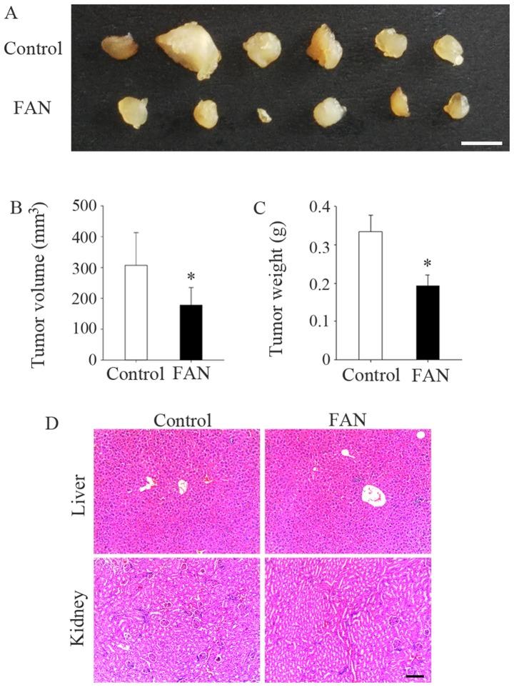 https://cdn.ncbi.nlm.nih.gov/pmc/blobs/868e/5504998/1ecc48324cac/IJMM-40-02-0311-g04.jpg