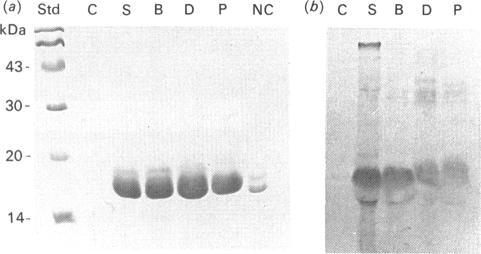 https://cdn.ncbi.nlm.nih.gov/pmc/blobs/8697/1150115/2eba7d804f31/biochemj00160-0192-a.jpg