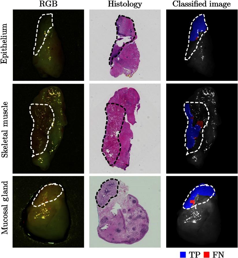 https://cdn.ncbi.nlm.nih.gov/pmc/blobs/869b/6975184/6c72e510e791/JBO-024-036007-g007.jpg