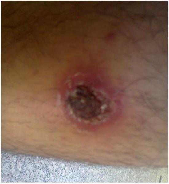 https://cdn.ncbi.nlm.nih.gov/pmc/blobs/869c/5256044/90f19ab919b7/IJPA-11-290-g002.jpg