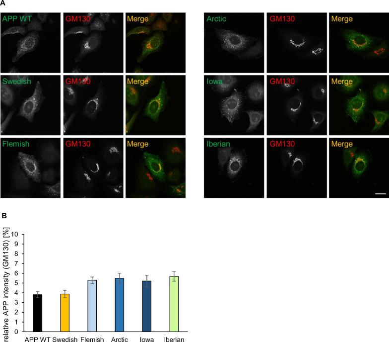 https://cdn.ncbi.nlm.nih.gov/pmc/blobs/86a3/10234039/3293f60c62e2/40478_2023_1577_Fig4_HTML.jpg