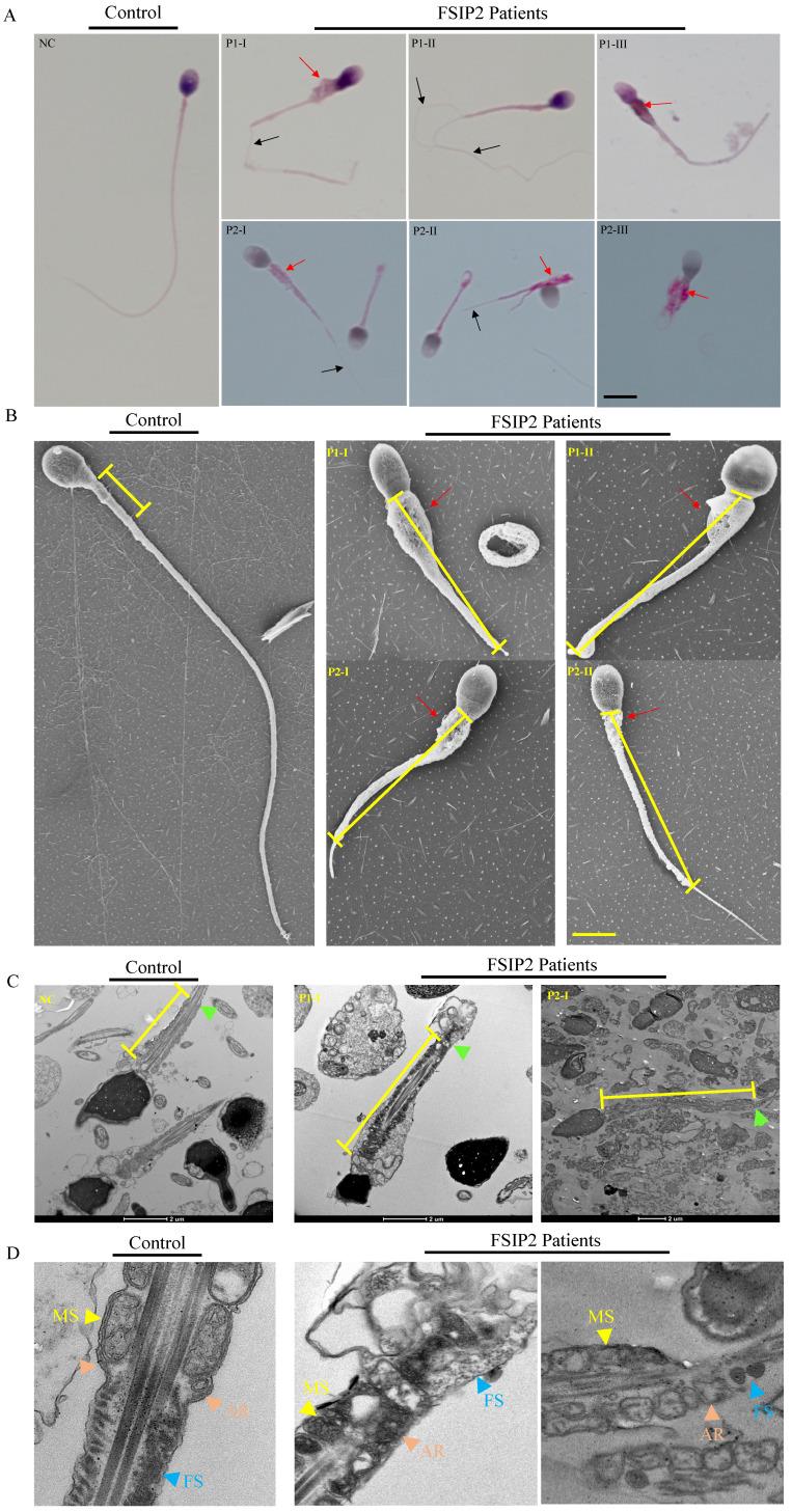 https://cdn.ncbi.nlm.nih.gov/pmc/blobs/86a6/9830513/806ebcdf19ef/ijbsv19p0393g002.jpg