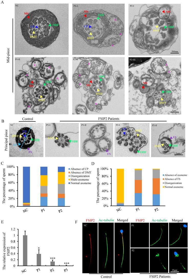 https://cdn.ncbi.nlm.nih.gov/pmc/blobs/86a6/9830513/9e49d75ab300/ijbsv19p0393g003.jpg