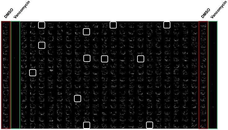 https://cdn.ncbi.nlm.nih.gov/pmc/blobs/86ae/3929655/f73dffa2ef77/pone.0089189.g006.jpg
