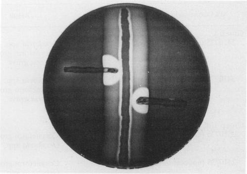 https://cdn.ncbi.nlm.nih.gov/pmc/blobs/86af/266153/fc885bba5704/jcm00023-0083-a.jpg