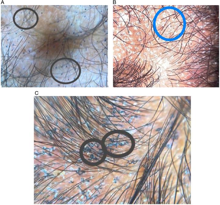 https://cdn.ncbi.nlm.nih.gov/pmc/blobs/86b0/10783287/624e099fce01/ms9-86-121-g002.jpg