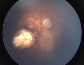 https://cdn.ncbi.nlm.nih.gov/pmc/blobs/86b9/5286683/ce5f0bec72b5/40942_2016_57_Fig2_HTML.jpg