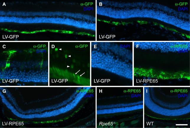 https://cdn.ncbi.nlm.nih.gov/pmc/blobs/86be/1630642/af81b5bdd8a4/pmed.0030347.g001.jpg