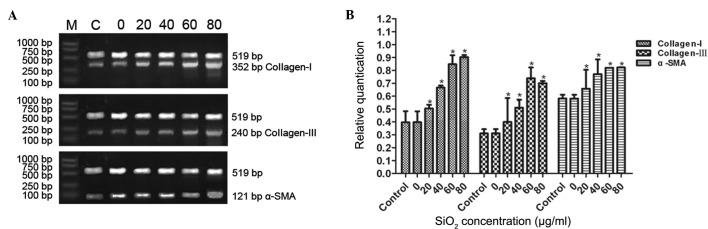 https://cdn.ncbi.nlm.nih.gov/pmc/blobs/86be/4581811/3ae516c7aa1b/MMR-12-04-5828-g04.jpg