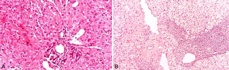 https://cdn.ncbi.nlm.nih.gov/pmc/blobs/86c3/8343494/5204480dada7/RJME-61-4-1085-fig2.jpg