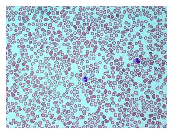 https://cdn.ncbi.nlm.nih.gov/pmc/blobs/86c7/3420701/df366344d596/CRIM.HEMATOLOGY2012-167653.001.jpg