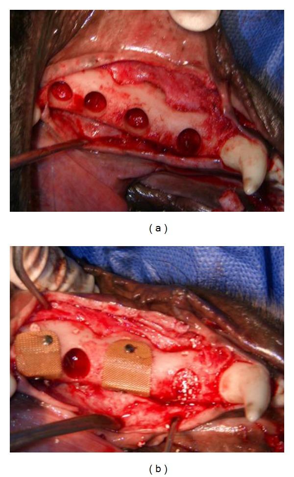 https://cdn.ncbi.nlm.nih.gov/pmc/blobs/86cc/3349124/2c97926d9307/TSWJ2012-196791.001.jpg