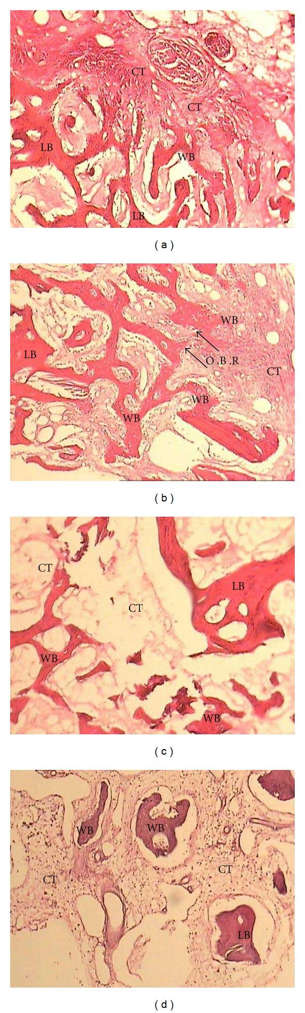 https://cdn.ncbi.nlm.nih.gov/pmc/blobs/86cc/3349124/eea7902d6f5f/TSWJ2012-196791.002.jpg
