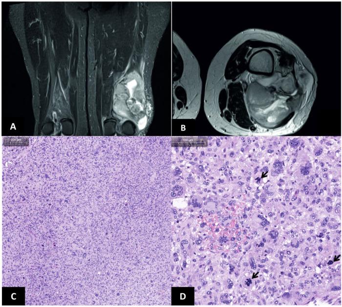 https://cdn.ncbi.nlm.nih.gov/pmc/blobs/86ce/11642494/f7e7f177b728/jcm-13-07176-g002.jpg