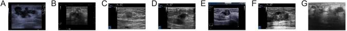 https://cdn.ncbi.nlm.nih.gov/pmc/blobs/86db/10758370/1beb4ed51b13/11517_2023_2922_Fig1_HTML.jpg