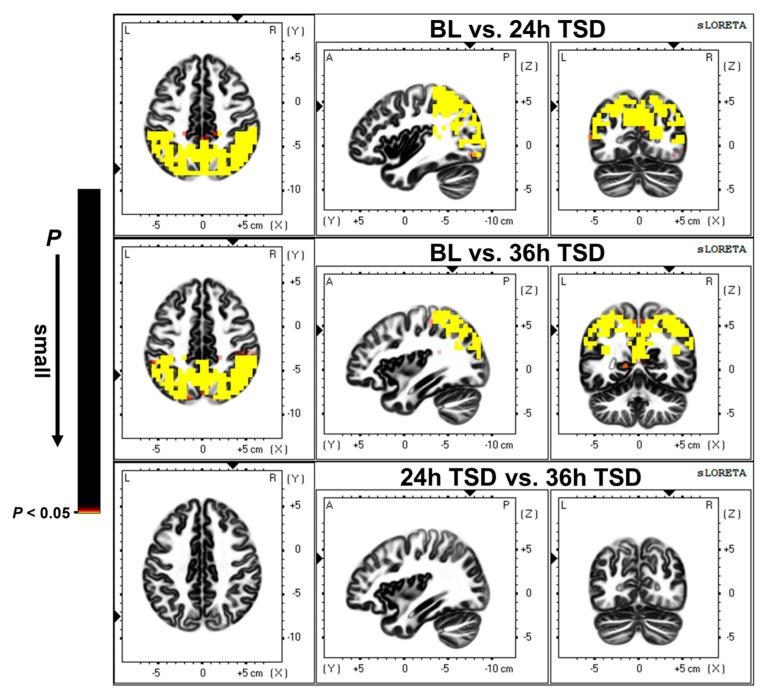 https://cdn.ncbi.nlm.nih.gov/pmc/blobs/86dd/10296734/9e3b4371695d/brainsci-13-00949-g002.jpg