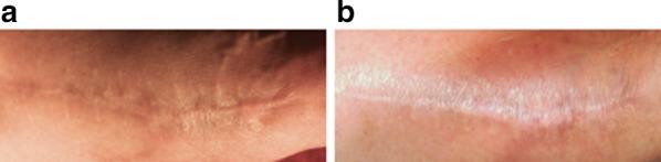 https://cdn.ncbi.nlm.nih.gov/pmc/blobs/86dd/4257951/1c686d55d9a5/13555_2014_65_Fig3_HTML.jpg