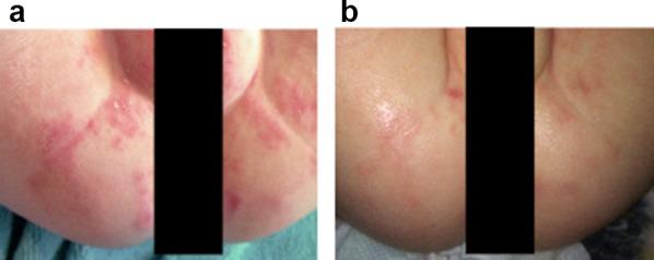 https://cdn.ncbi.nlm.nih.gov/pmc/blobs/86dd/4257951/97052a26283c/13555_2014_65_Fig5_HTML.jpg