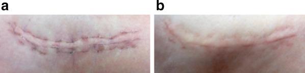 https://cdn.ncbi.nlm.nih.gov/pmc/blobs/86dd/4257951/f66c55a1086c/13555_2014_65_Fig2_HTML.jpg