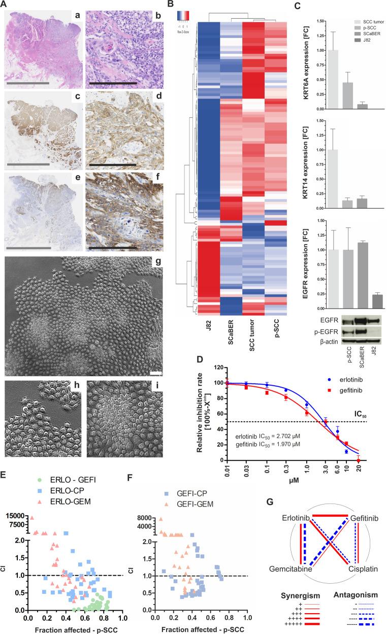 https://cdn.ncbi.nlm.nih.gov/pmc/blobs/86e1/7605436/311c2c3b114c/41388_2020_1465_Fig6_HTML.jpg