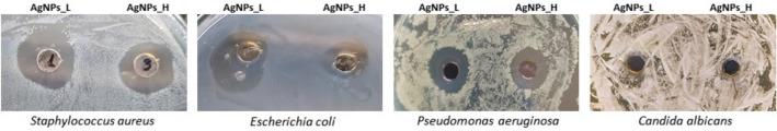 https://cdn.ncbi.nlm.nih.gov/pmc/blobs/86e6/8242066/bf4eba0722a2/41598_2021_92812_Fig4_HTML.jpg