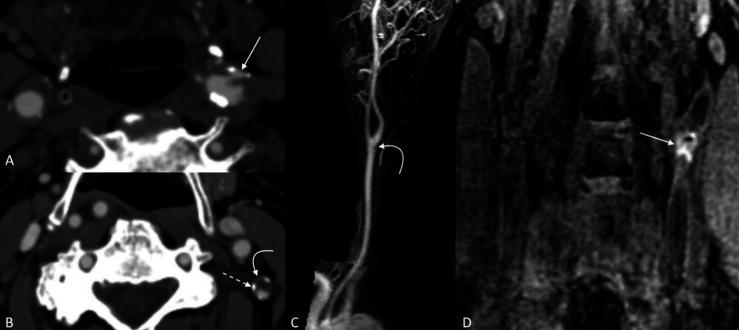 https://cdn.ncbi.nlm.nih.gov/pmc/blobs/86e6/9240461/2f52fa8a574c/svn-2021-000939f01.jpg