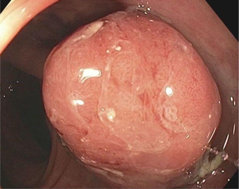 https://cdn.ncbi.nlm.nih.gov/pmc/blobs/86f1/12236287/0233107b4cc5/RJME-66-1-99-fig4.jpg