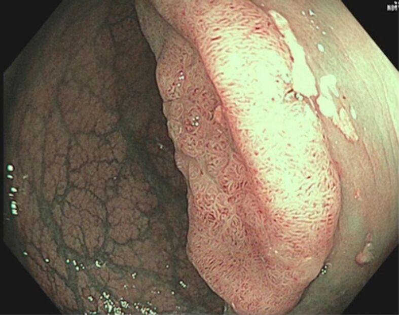 https://cdn.ncbi.nlm.nih.gov/pmc/blobs/86f1/12236287/28b8cb79865e/RJME-66-1-99-fig1.jpg