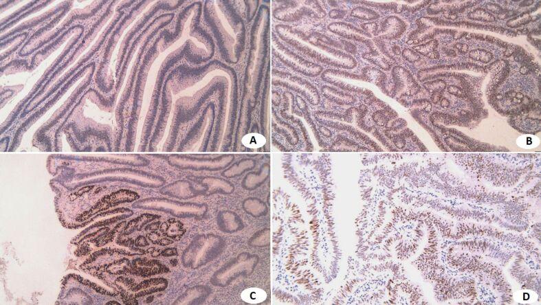 https://cdn.ncbi.nlm.nih.gov/pmc/blobs/86f1/12236287/a829a21c08fb/RJME-66-1-99-fig8.jpg