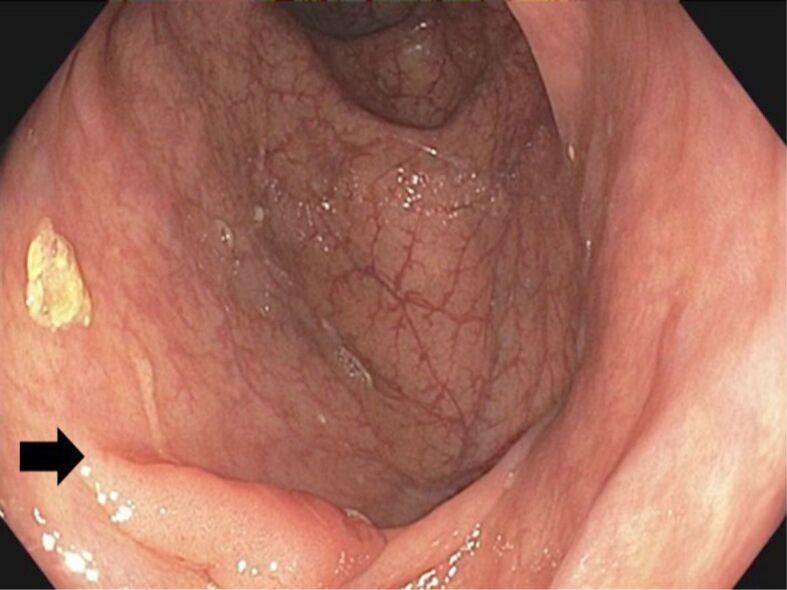 https://cdn.ncbi.nlm.nih.gov/pmc/blobs/86f1/12236287/e91544c77fa3/RJME-66-1-99-fig5.jpg