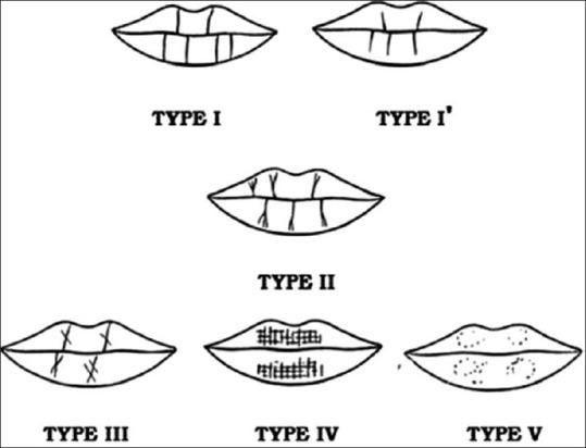 https://cdn.ncbi.nlm.nih.gov/pmc/blobs/870e/3722715/e4c7f3aa724a/JPBS-5-95-g001.jpg