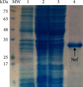 https://cdn.ncbi.nlm.nih.gov/pmc/blobs/8712/8081596/6bae33df3554/JIR2021-5538348.003.jpg