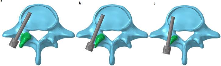 https://cdn.ncbi.nlm.nih.gov/pmc/blobs/8715/12354452/a4948c4d9440/fbioe-13-1481719-g002.jpg