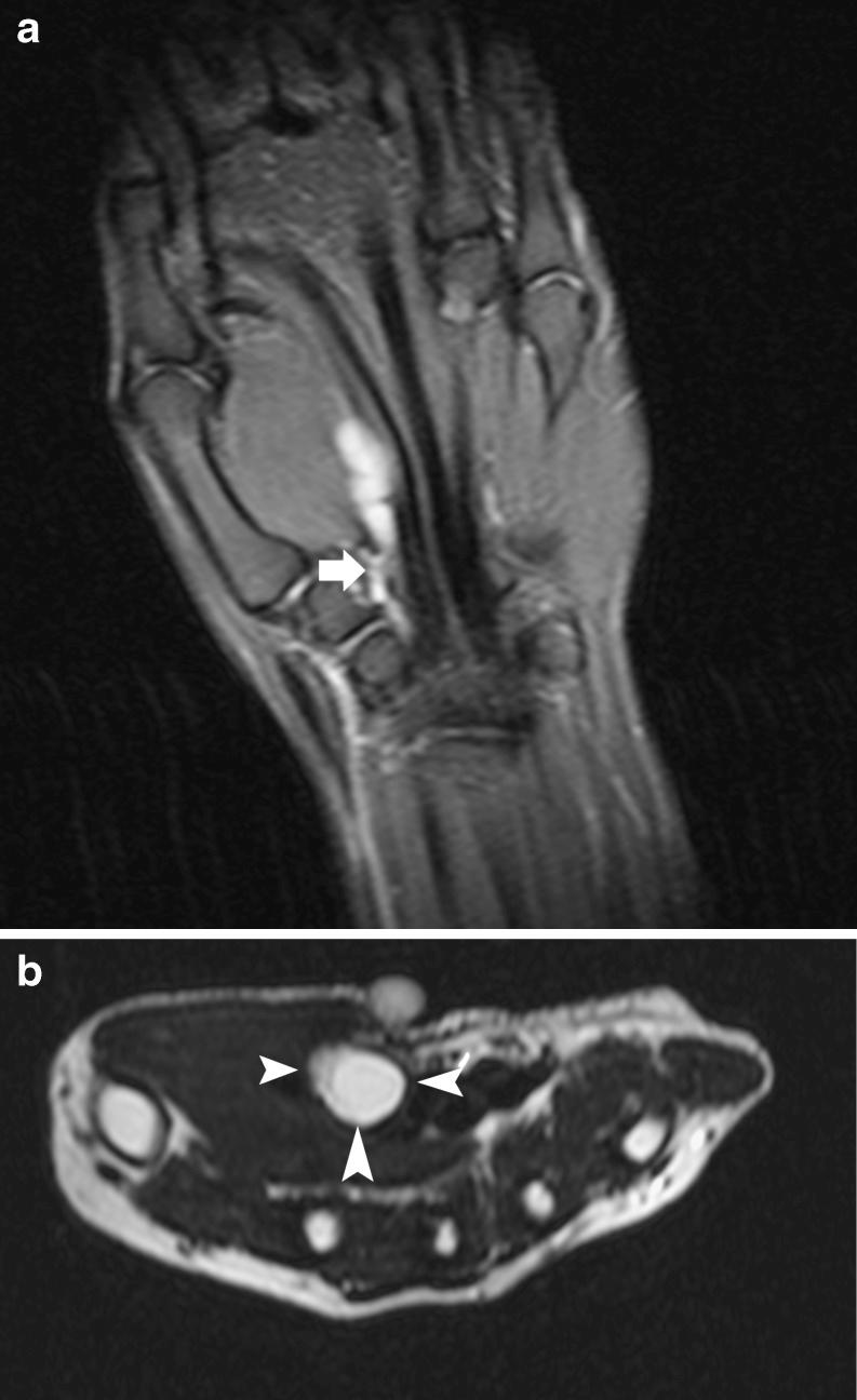 https://cdn.ncbi.nlm.nih.gov/pmc/blobs/8718/3289001/8149d082b0b6/13244_2011_76_Fig3_HTML.jpg
