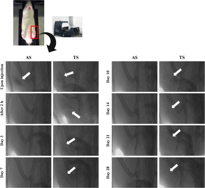 https://cdn.ncbi.nlm.nih.gov/pmc/blobs/871b/11256175/16d4ad46bfff/BTM2-9-e10649-g006.jpg