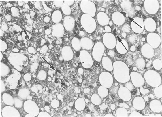 https://cdn.ncbi.nlm.nih.gov/pmc/blobs/871b/1916365/fa0d9e77342e/amjpathol00189-0049-a.jpg